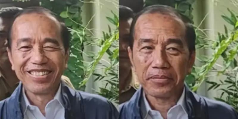 Jokowi Bantah Isu Dirawat di Rumah Sakit Jepang, Alergi Kulit Mulai Membaik  